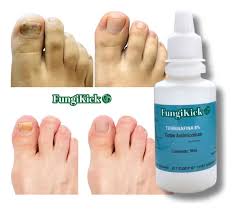 🔥 FungiKick® | Tónico Antihongos para Uñas – Cura Rápida y Natural