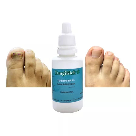 🔥 FungiKick® | Tónico Antihongos para Uñas – Cura Rápida y Natural